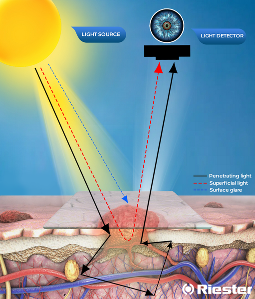 Non-polarised-dermoscopy-1
