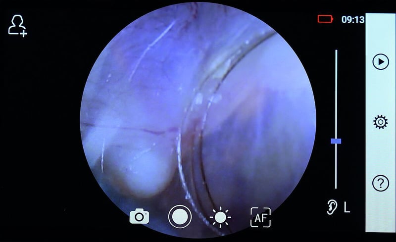 csm_RCS-100_24_3_eardrum_77959bf5c4
